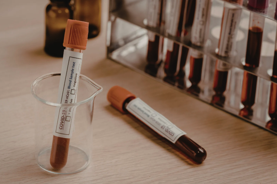 Alterações hormonais